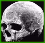 4.500 senelik 'Ameliyatlı' kafatasları